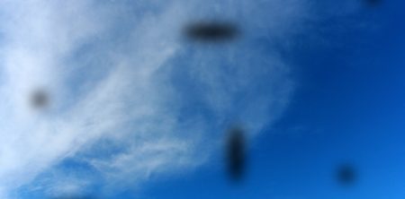 Eye Floaters, Flashers, and Spots